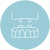 implant supported dentures